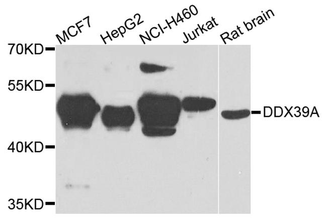 DDX39 Antibody in Western Blot (WB)