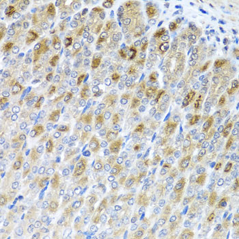 MTX2 Antibody in Immunohistochemistry (Paraffin) (IHC (P))