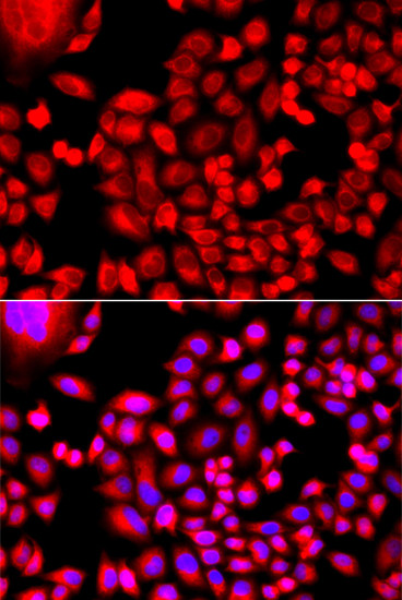 MTHFD1L Antibody in Immunocytochemistry (ICC/IF)