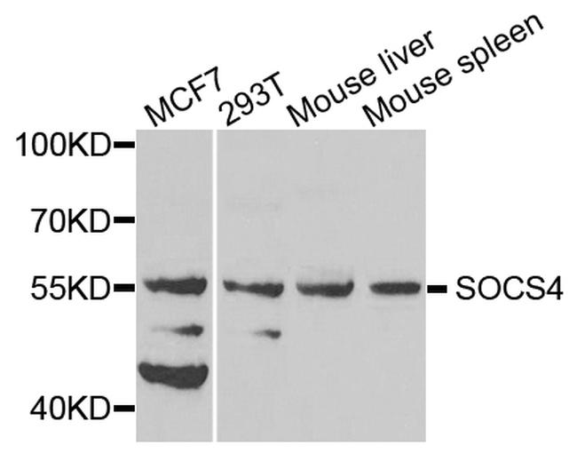 SOCS4 Antibody in Western Blot (WB)