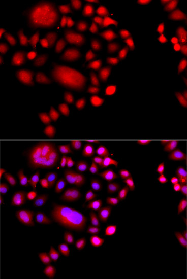 POLR1D Antibody in Immunocytochemistry (ICC/IF)