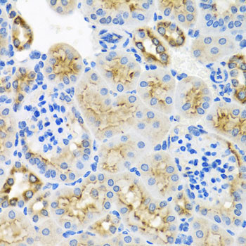 STX7 Antibody in Immunohistochemistry (Paraffin) (IHC (P))