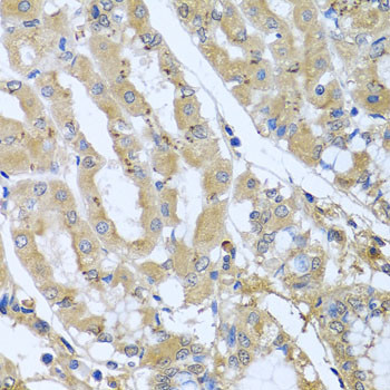 STX7 Antibody in Immunohistochemistry (Paraffin) (IHC (P))