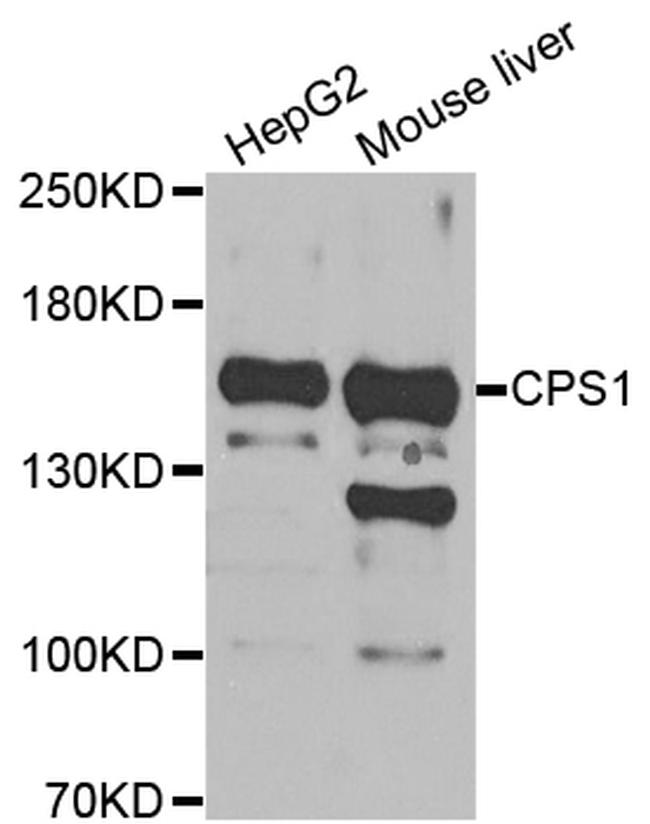 CPS1 Antibody in Western Blot (WB)