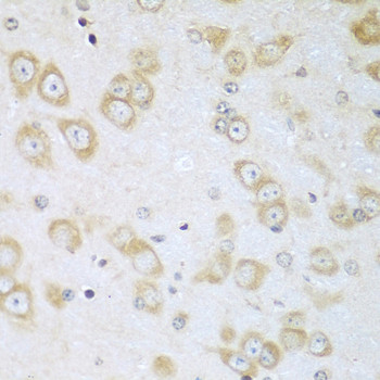 ACOX1 Antibody in Immunohistochemistry (Paraffin) (IHC (P))