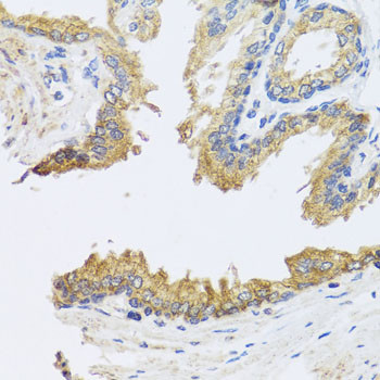 ARL6 Antibody in Immunohistochemistry (Paraffin) (IHC (P))