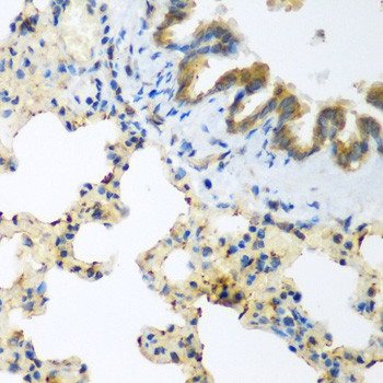 LLGL2 Antibody in Immunohistochemistry (Paraffin) (IHC (P))