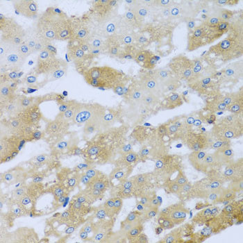 AP1M2 Antibody in Immunohistochemistry (Paraffin) (IHC (P))