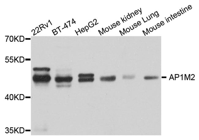 AP1M2 Antibody in Western Blot (WB)