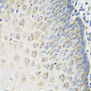 MSRB2 Antibody in Immunohistochemistry (Paraffin) (IHC (P))