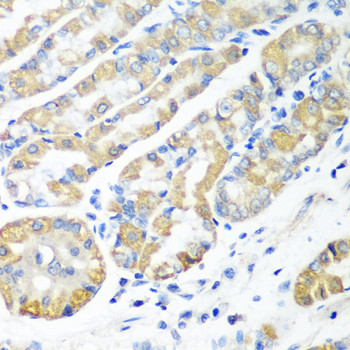 MSRB2 Antibody in Immunohistochemistry (Paraffin) (IHC (P))