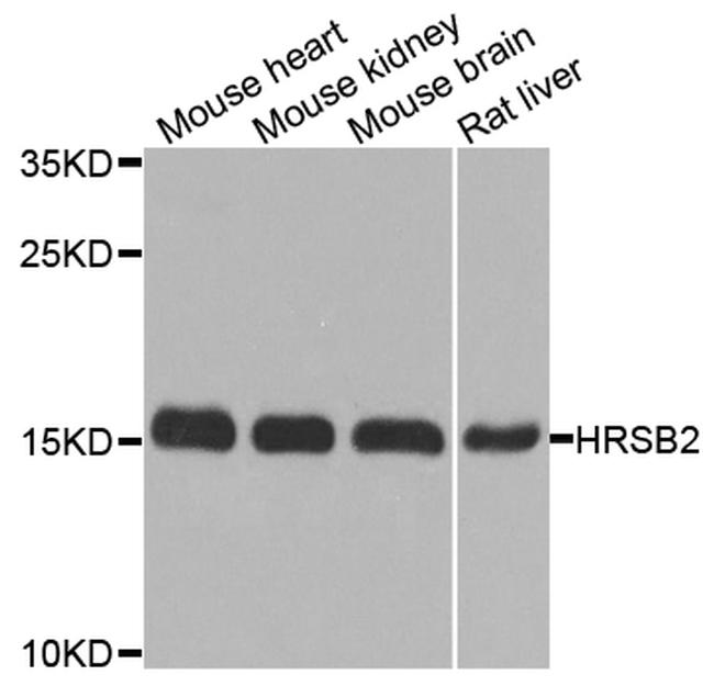 MSRB2 Antibody in Western Blot (WB)