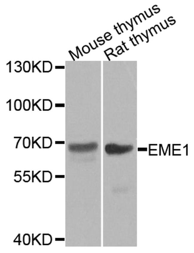 EME1 Antibody in Western Blot (WB)