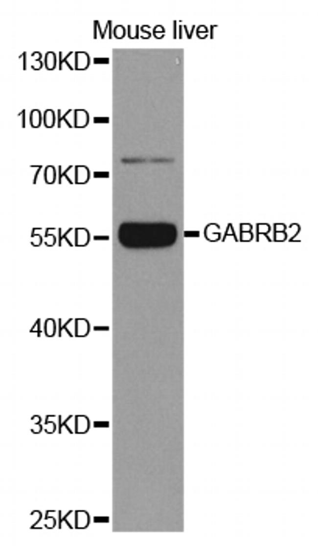 GABRB2 Antibody in Western Blot (WB)