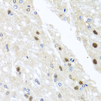 YTHDF3 Antibody in Immunohistochemistry (Paraffin) (IHC (P))