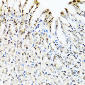 YTHDF3 Antibody in Immunohistochemistry (Paraffin) (IHC (P))