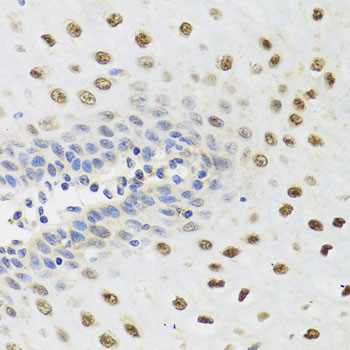 YTHDF3 Antibody in Immunohistochemistry (Paraffin) (IHC (P))