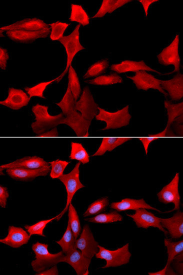 GCLM Antibody in Immunocytochemistry (ICC/IF)