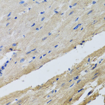 FECH Antibody in Immunohistochemistry (Paraffin) (IHC (P))