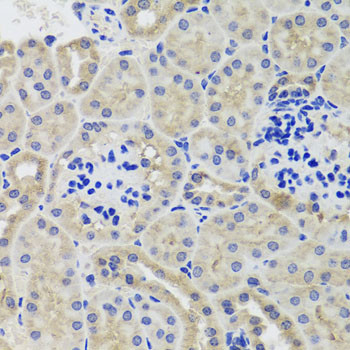 HK3 Antibody in Immunohistochemistry (Paraffin) (IHC (P))