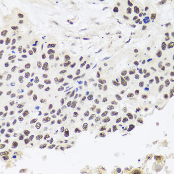 RPP30 Antibody in Immunohistochemistry (Paraffin) (IHC (P))