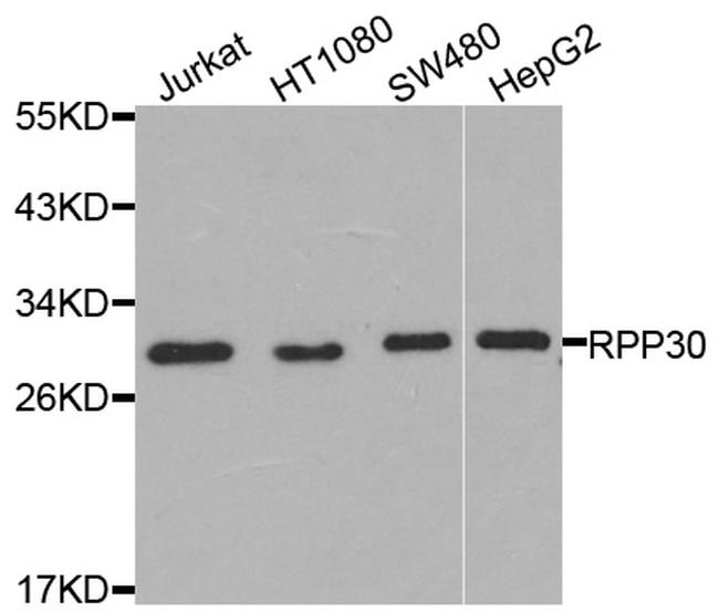 RPP30 Antibody in Western Blot (WB)