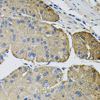 Thrombospondin 2 Antibody in Immunohistochemistry (Paraffin) (IHC (P))