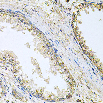 CYP46A1 Antibody in Immunohistochemistry (Paraffin) (IHC (P))