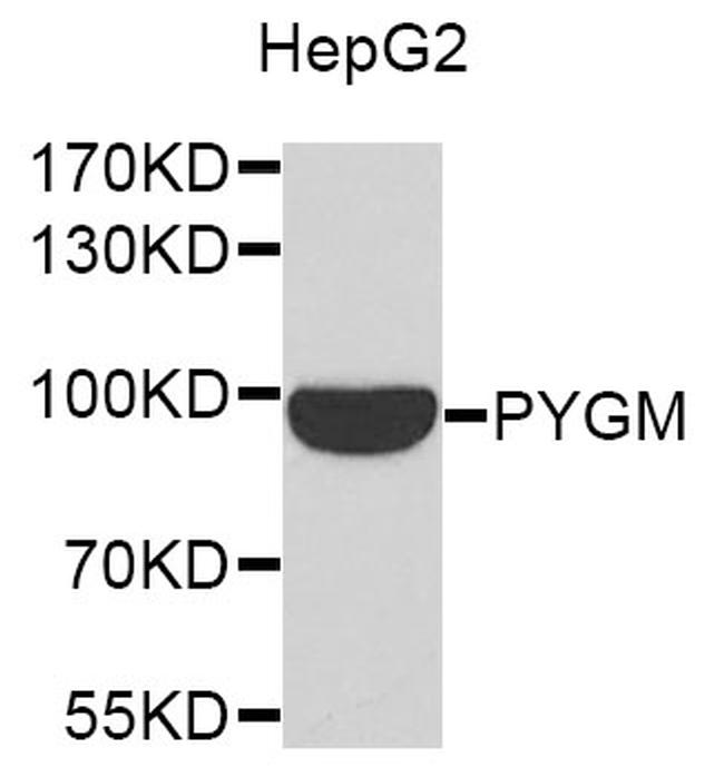 PYGM Antibody in Western Blot (WB)