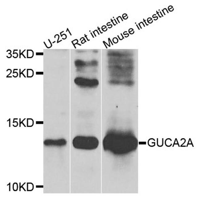 GUCA2A Antibody in Western Blot (WB)