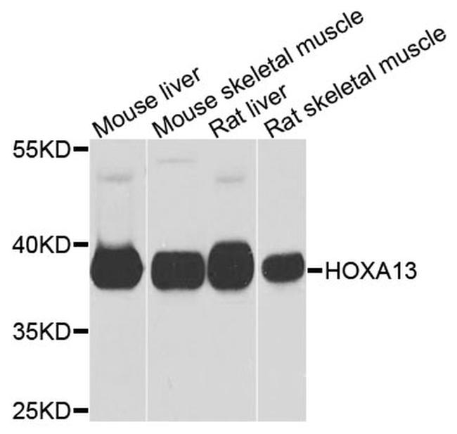 HOXA13 Antibody in Western Blot (WB)