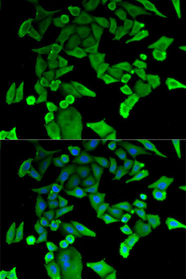 TPT1 Antibody in Immunocytochemistry (ICC/IF)