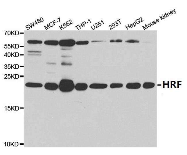 TPT1 Antibody in Western Blot (WB)