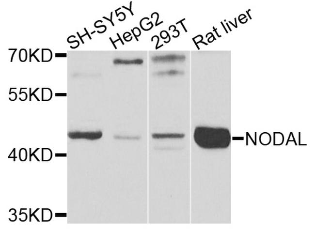 Nodal Antibody in Western Blot (WB)