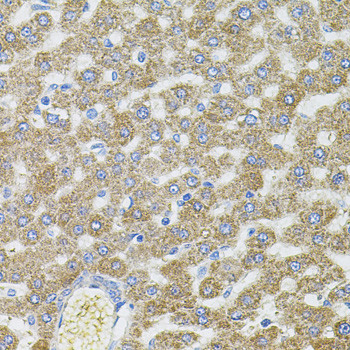 CEP164 Antibody in Immunohistochemistry (Paraffin) (IHC (P))