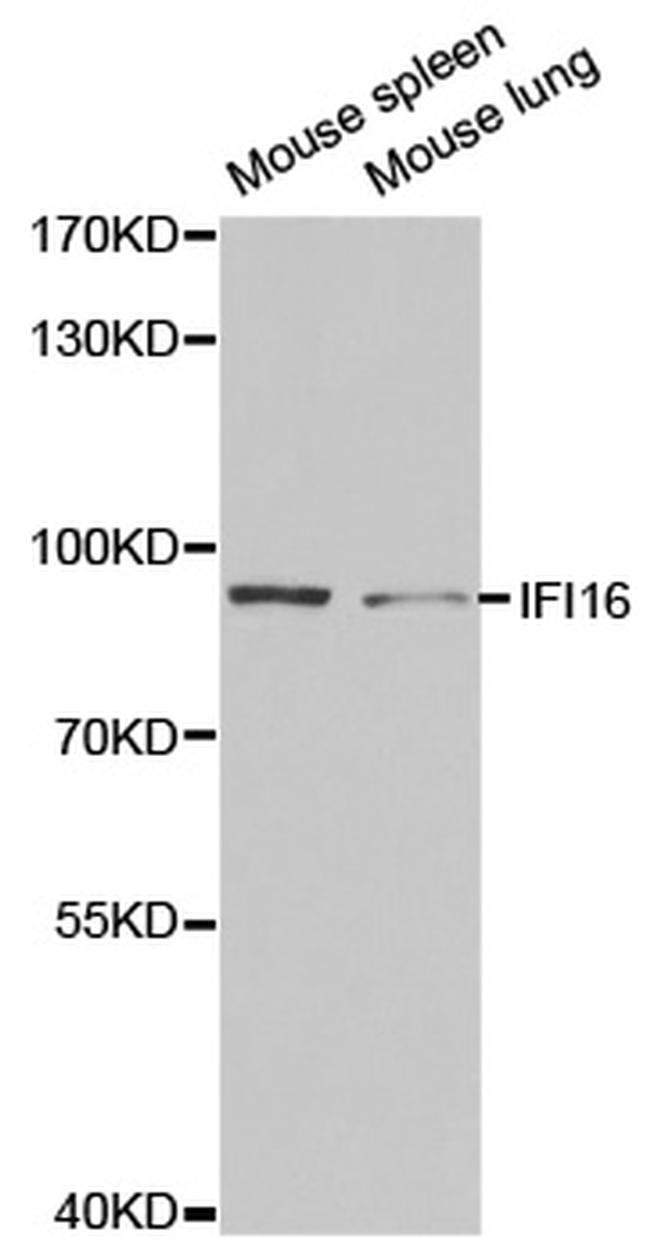 IFI16 Antibody in Western Blot (WB)