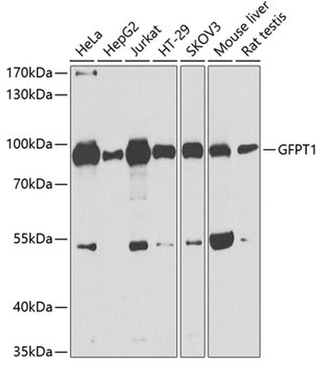 GFPT1 Antibody in Western Blot (WB)