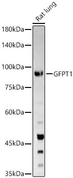 GFPT1 Antibody in Western Blot (WB)