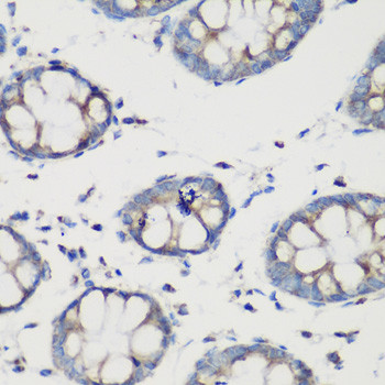 GluD1 Antibody in Immunohistochemistry (Paraffin) (IHC (P))