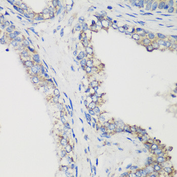 GluD1 Antibody in Immunohistochemistry (Paraffin) (IHC (P))