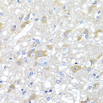 SKIP Antibody in Immunohistochemistry (Paraffin) (IHC (P))