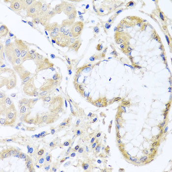 SKIP Antibody in Immunohistochemistry (Paraffin) (IHC (P))