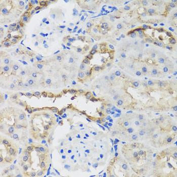 B9D1 Antibody in Immunohistochemistry (Paraffin) (IHC (P))