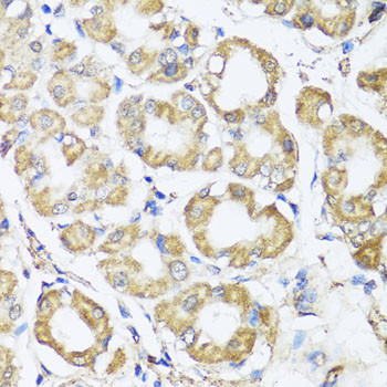 B9D1 Antibody in Immunohistochemistry (Paraffin) (IHC (P))