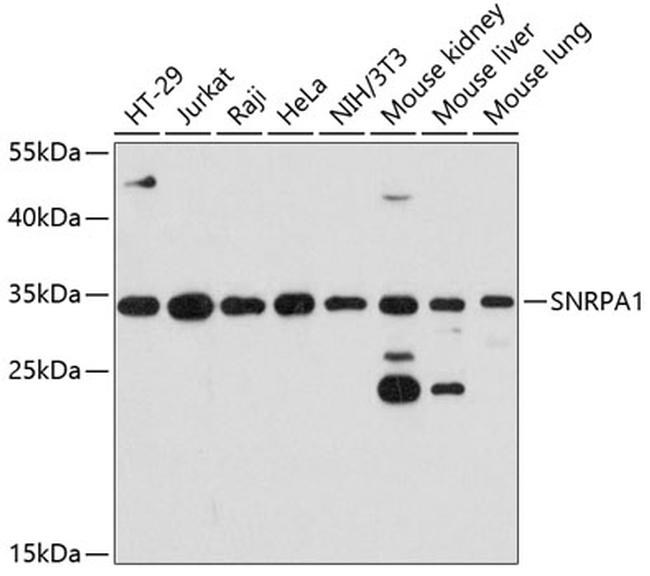 SNRPA1 Antibody in Western Blot (WB)