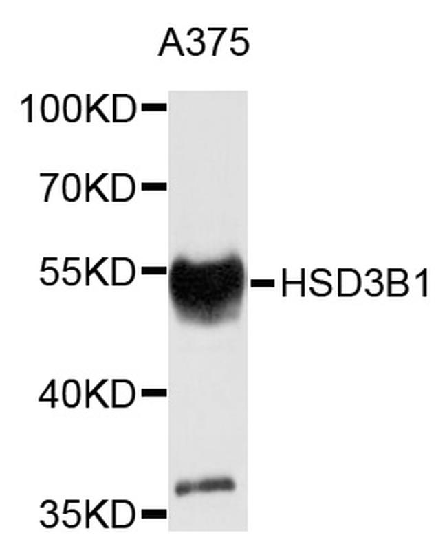 HSD3B1 Antibody in Western Blot (WB)