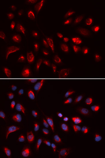 CHRM5 Antibody in Immunocytochemistry (ICC/IF)