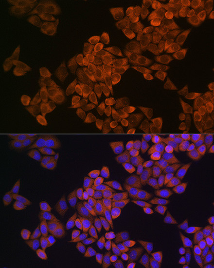 SQLE Antibody in Immunocytochemistry (ICC/IF)