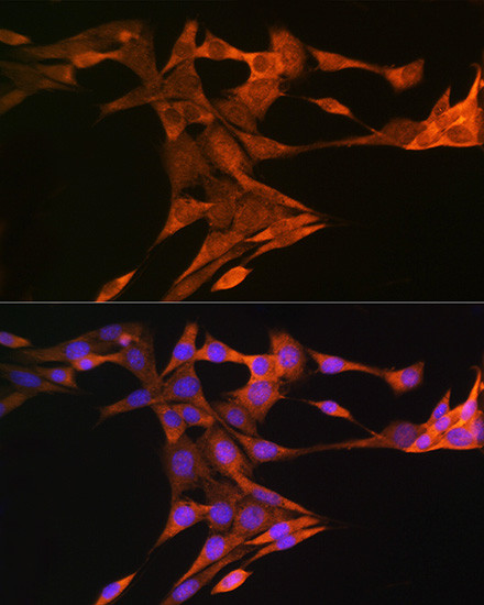 SQLE Antibody in Immunocytochemistry (ICC/IF)