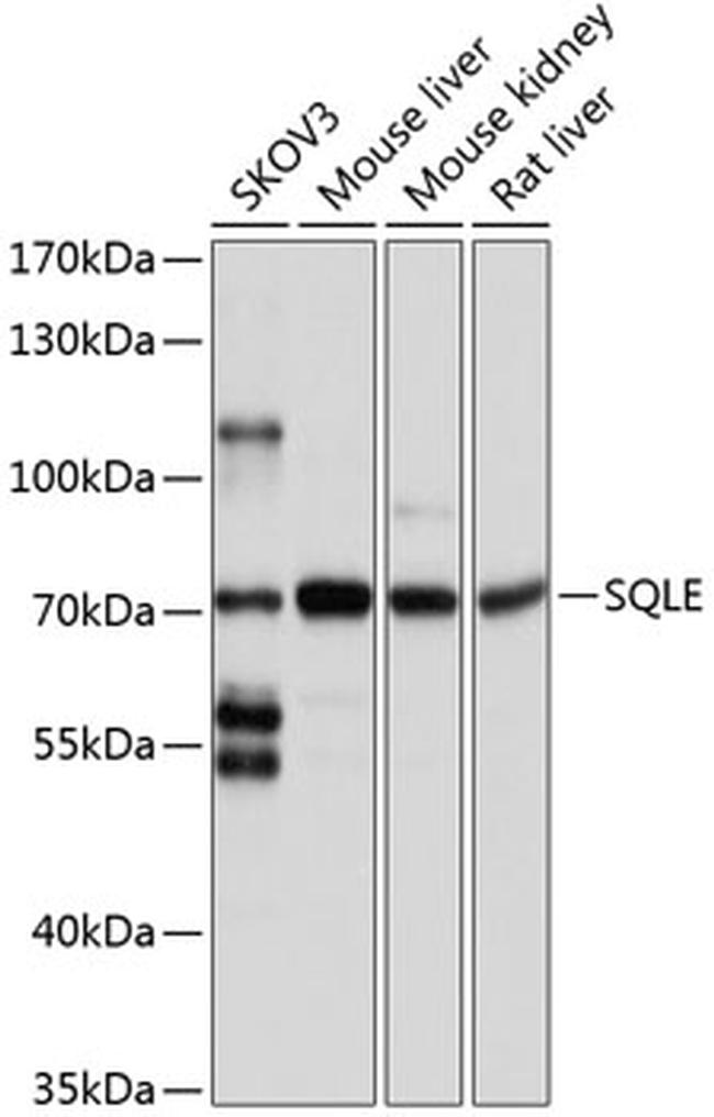 SQLE Antibody in Western Blot (WB)